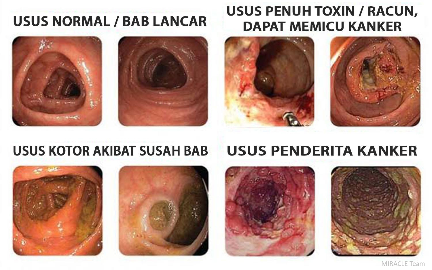 Presentasi AFC 15des25 short_page-0027