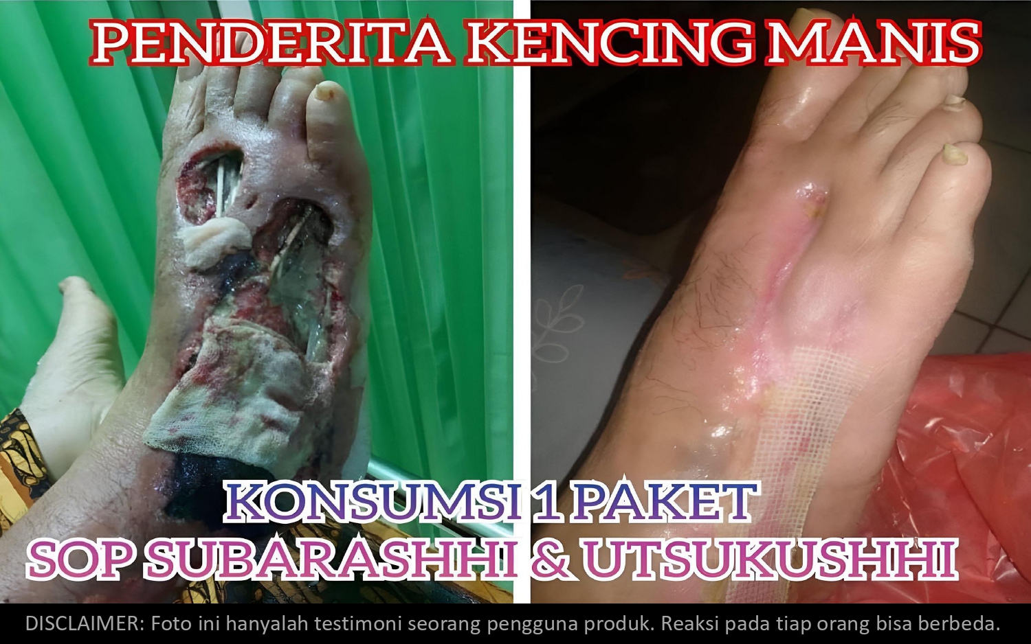Presentasi AFC 15des25_page-0029