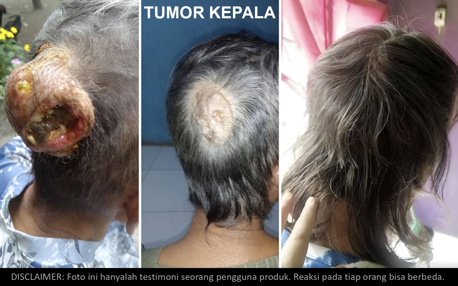 Presentasi AFC 15des25_page-0030
