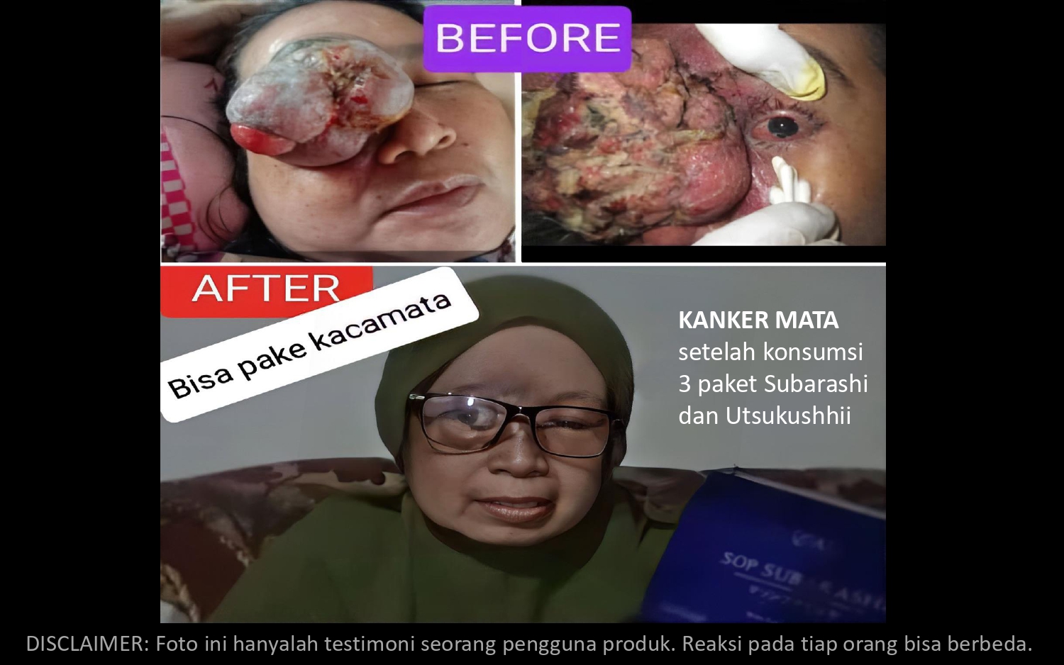 Presentasi AFC 15des25_page-0032